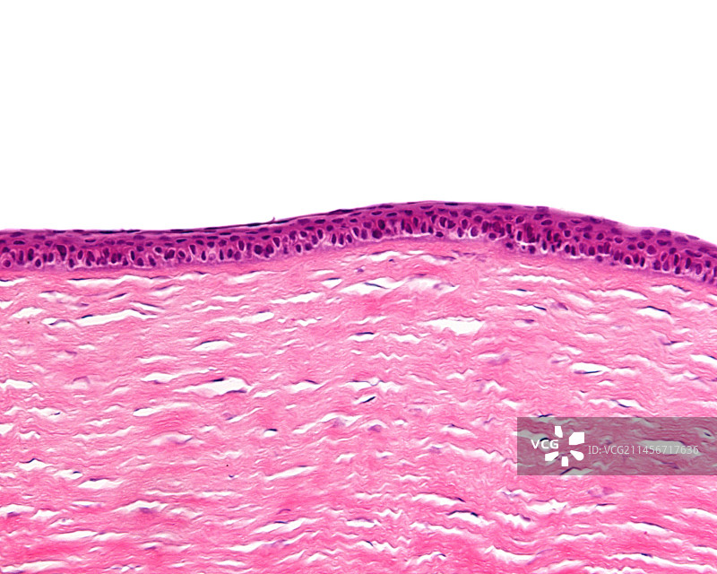 角膜，光学显微照片图片素材