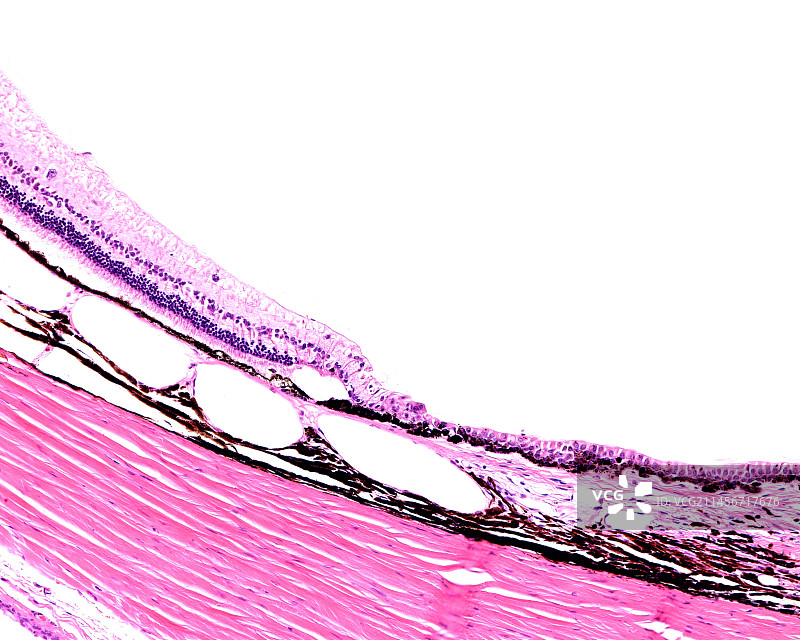 视网膜和睫状体边框，光学显微照片图片素材