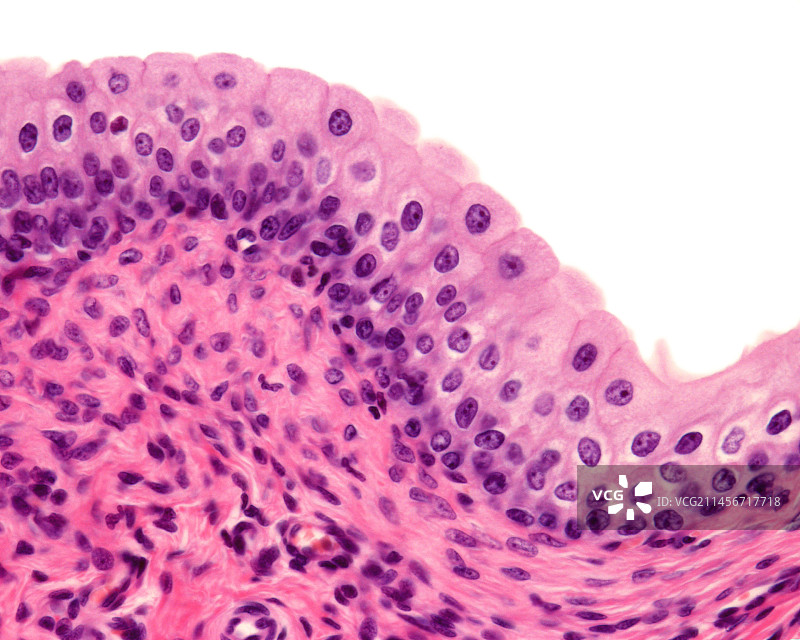膀胱移行上皮细胞显微照片图片素材