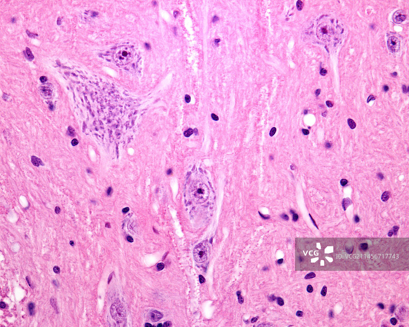 运动神经元中的尼氏小体，光学显微照片图片素材