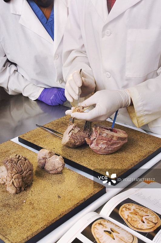 大脑解剖图片素材