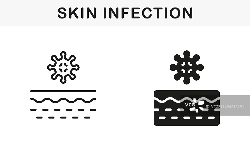 带有微生物群和病毒符号的皮肤层图片素材