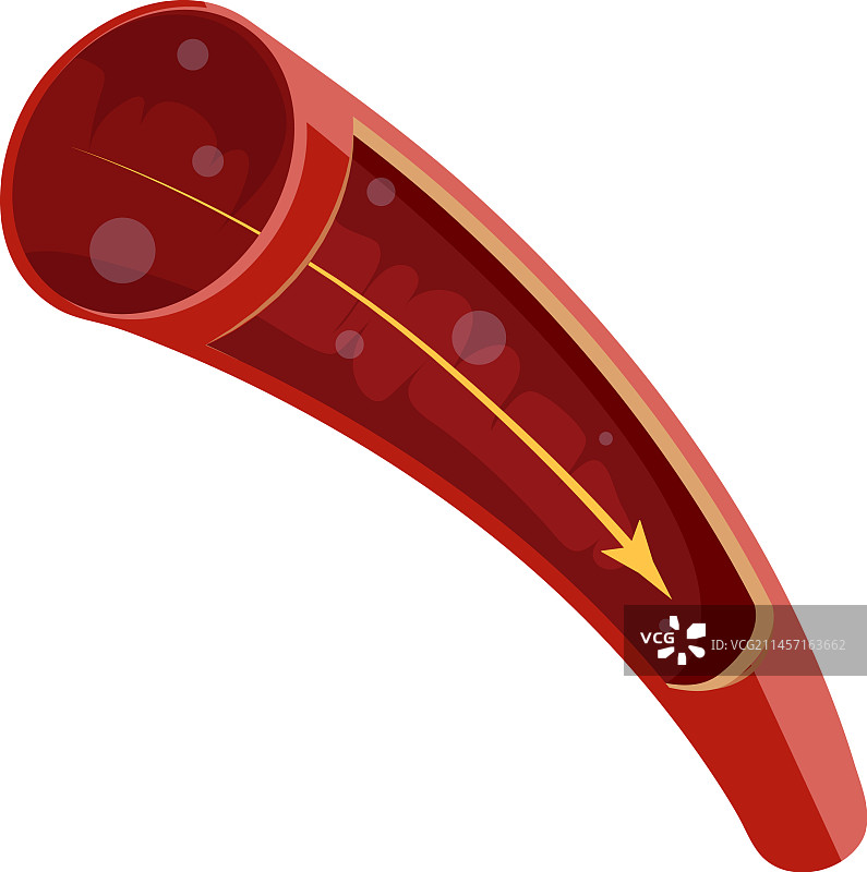 带血的人体动脉医学图图片素材