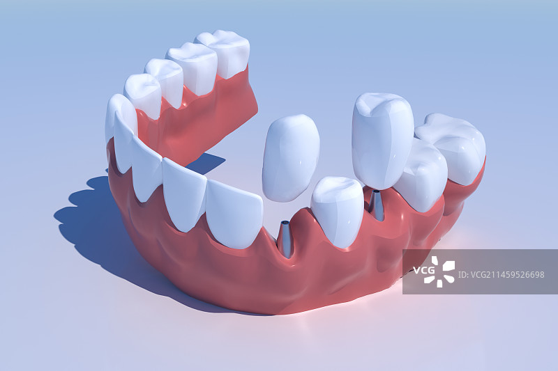 蓝色背景下假牙的高角度视图图片素材