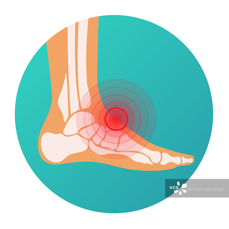 人足部疼痛定位红色圆圈图片素材