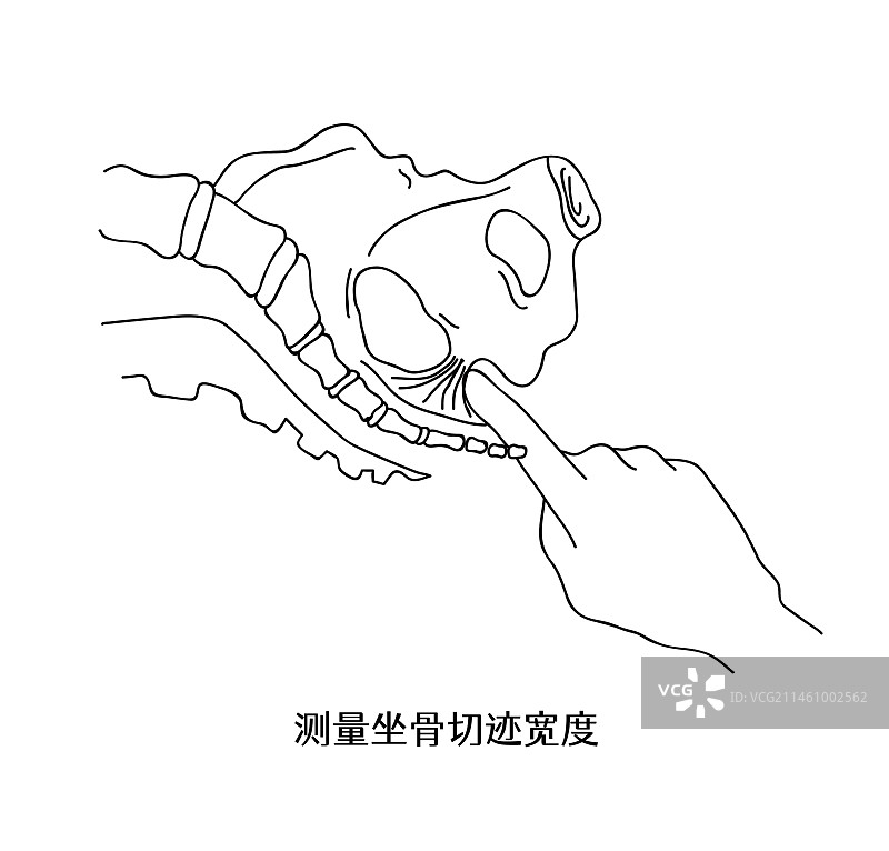 测量坐骨切迹宽度图片素材