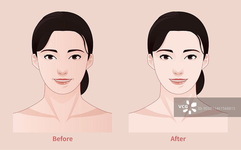 脸部皱纹 医美案例 美容案例 女人图片素材