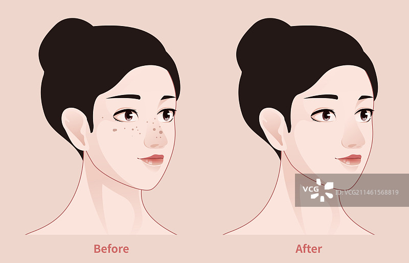 色斑 医美案例 轻医美案例 人物图片素材