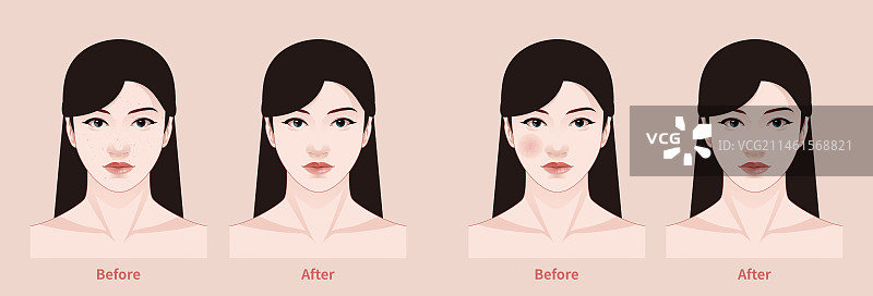 色斑 红血丝 美容案例 女性图片素材