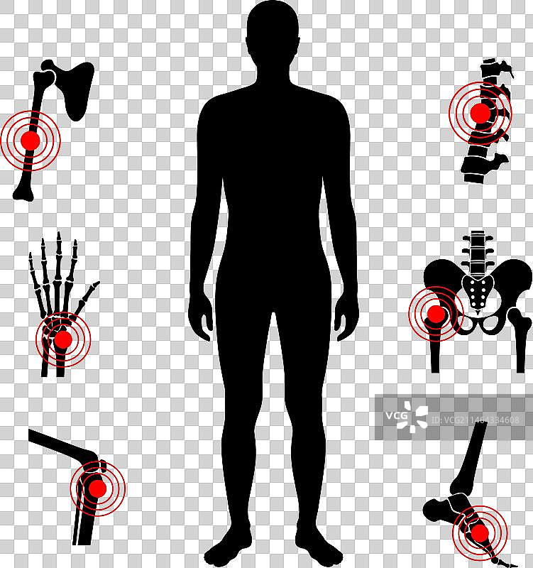 成人骨髓炎图片素材