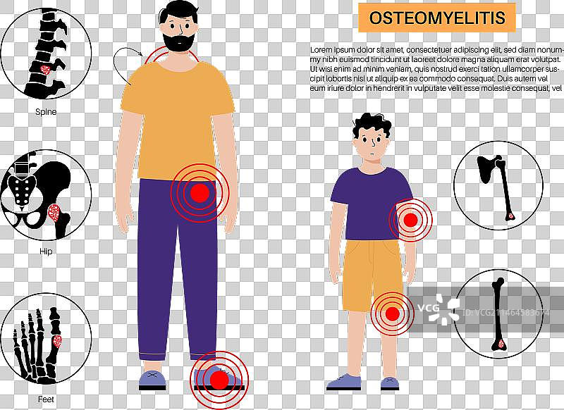 儿童和成人骨髓炎图片素材