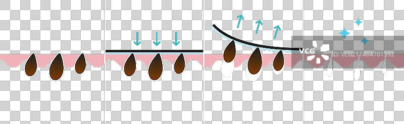 去除黑头过程图片素材