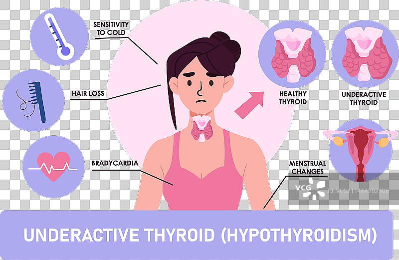 甲状腺功能减退症状合集图片素材