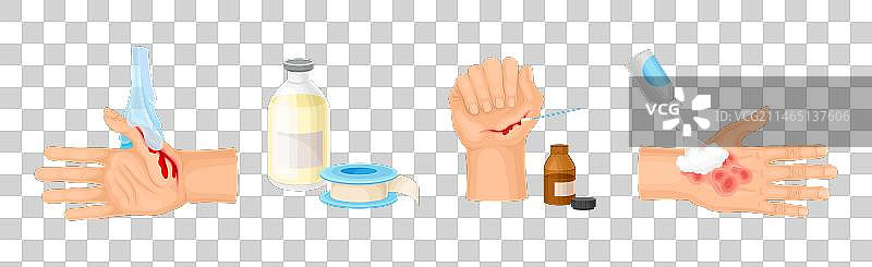 受伤的皮肤和伤口急救图片素材