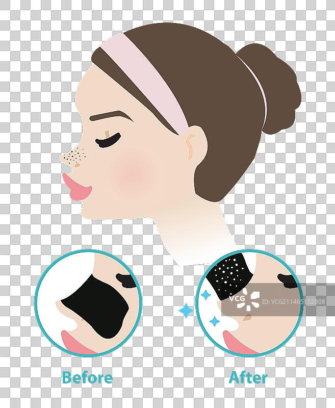 使用黑头贴前后的效果图片素材