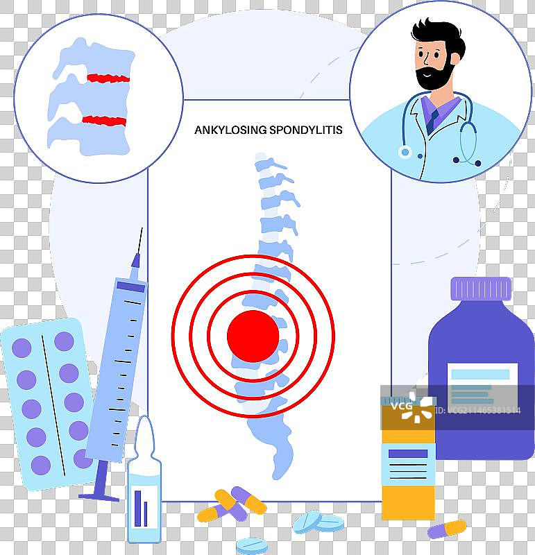 强直性脊柱炎疾病图片素材