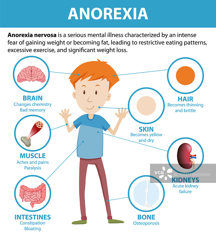患有厌食症的男性卡通解剖图图片素材