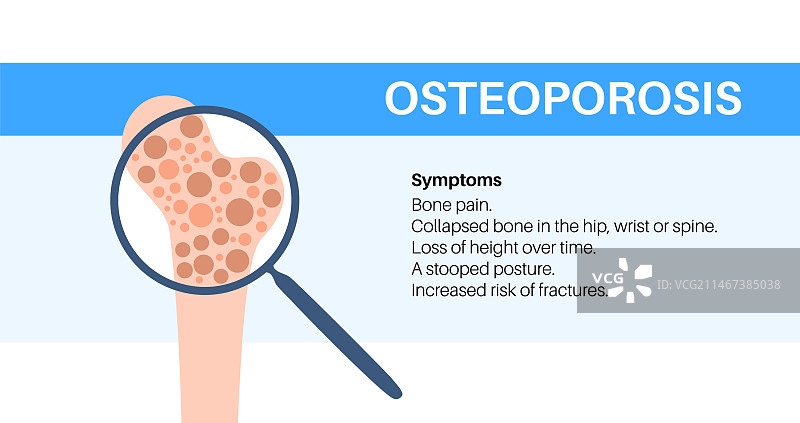 骨质疏松症医疗海报图片素材