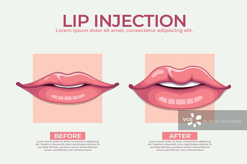 手绘丰唇信息图图片素材