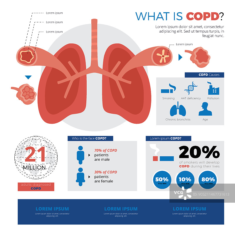 手绘慢性阻塞性肺病信息图模板图片素材
