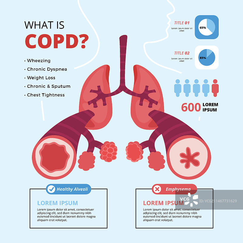 手绘慢性阻塞性肺病信息图图片素材
