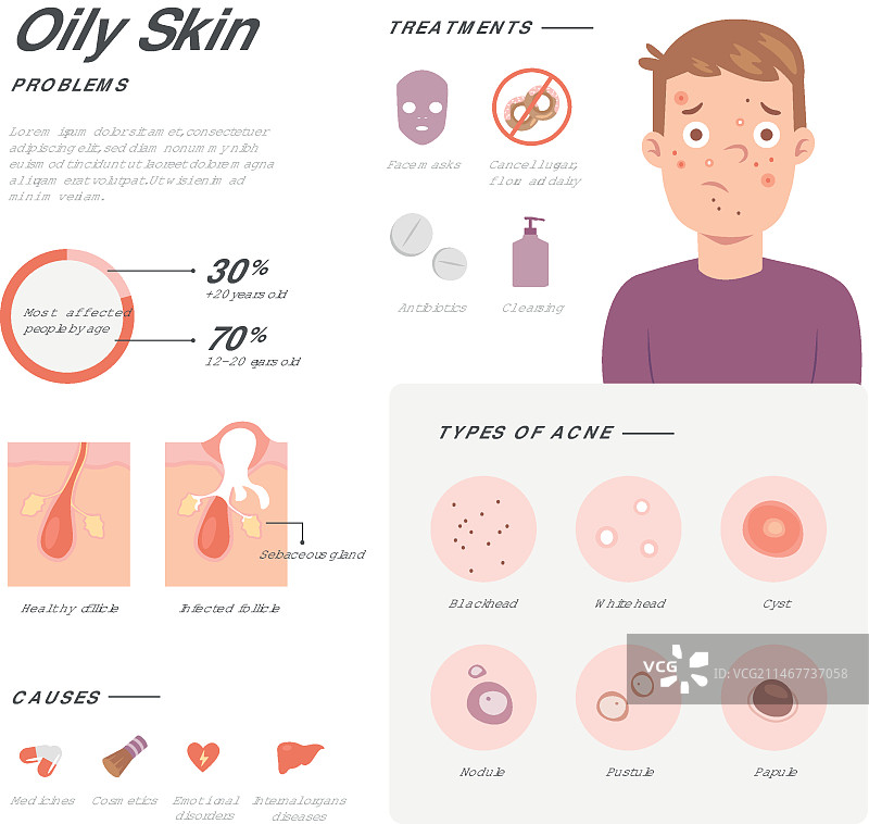 手绘油性皮肤问题信息图图片素材