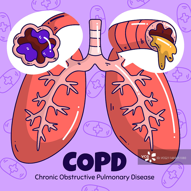 手绘慢性阻塞性肺病插画图片素材