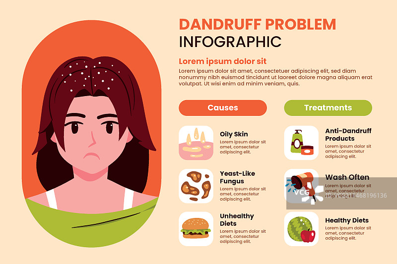 扁平风格头皮屑信息图图片素材