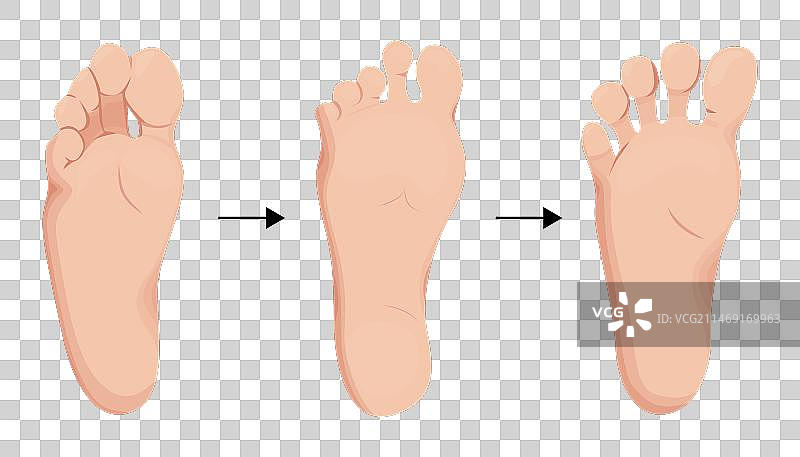 赤脚鞋护理步骤图片素材