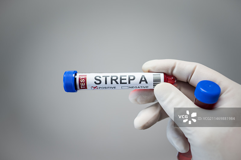 A型链球菌病毒血样，医疗卫生防疫主题图片素材