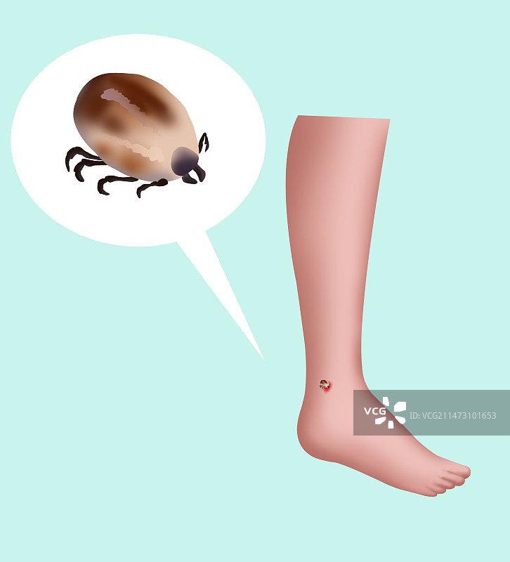 蜱虫螨虫有害病毒伤害身体健康虫子毒虫危害四害防范危险危机科普知识插画图片素材