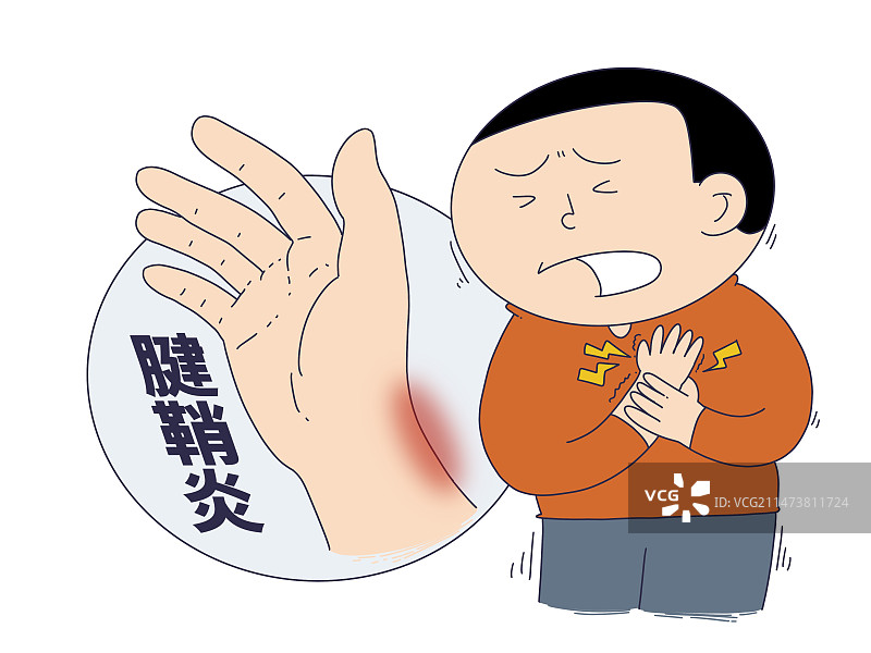 插画：健康疾病，腱鞘炎图片素材