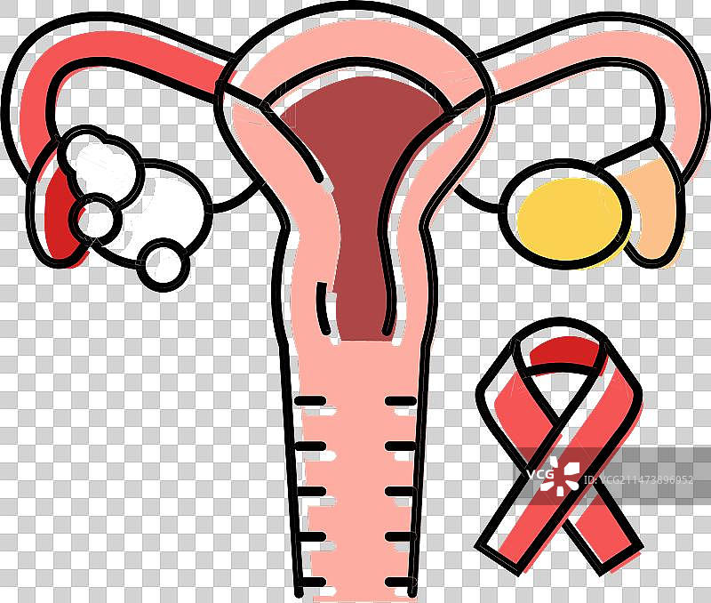 子宫内膜癌彩色图标图片素材