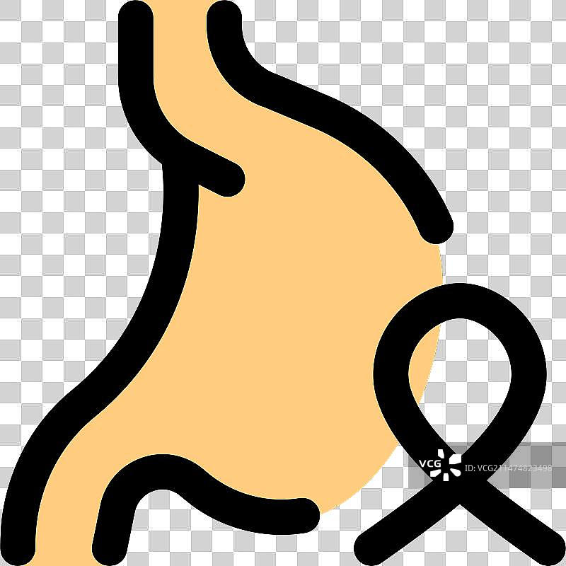 与胃溃疡和其他疾病相关的结肠癌图片素材