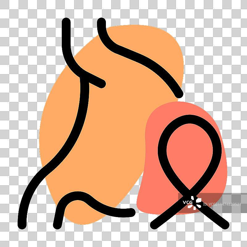 与胃溃疡和其他疾病相关的结肠癌图片素材