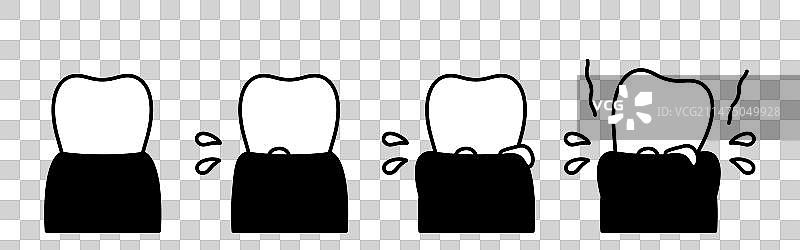 牙周疾病进展图简笔画图片素材