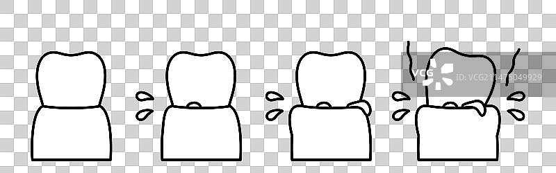 牙周疾病进展图简笔画图片素材