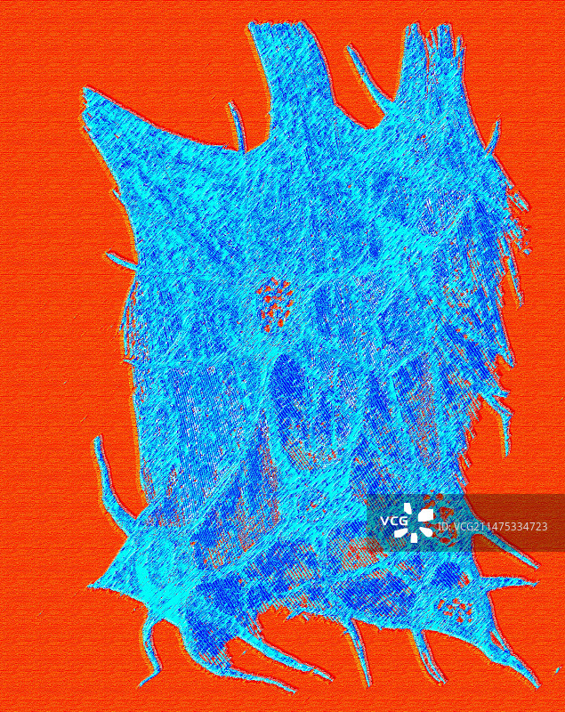 19世纪的脊髓细胞图片素材
