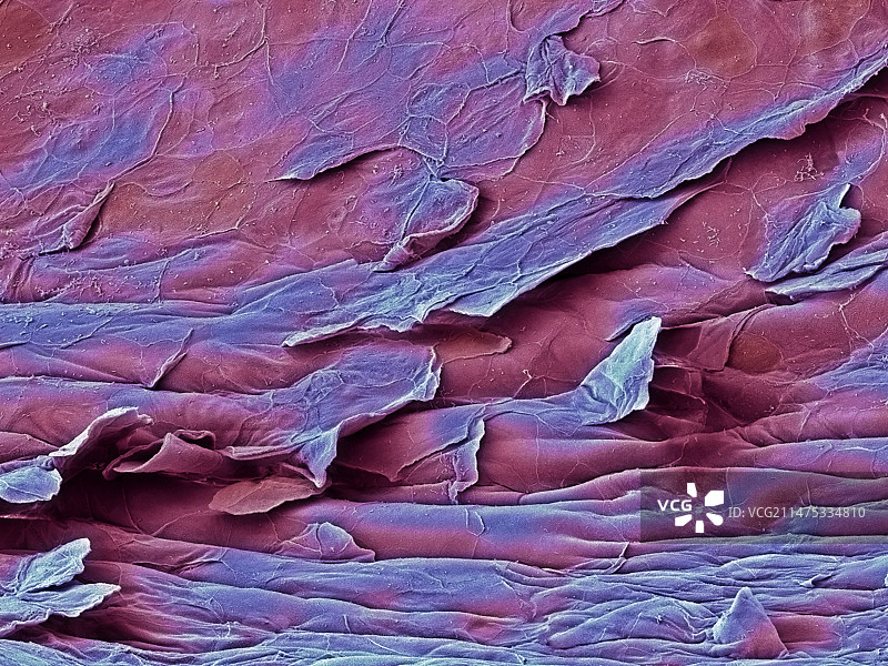 阴道内膜扫描电镜图图片素材
