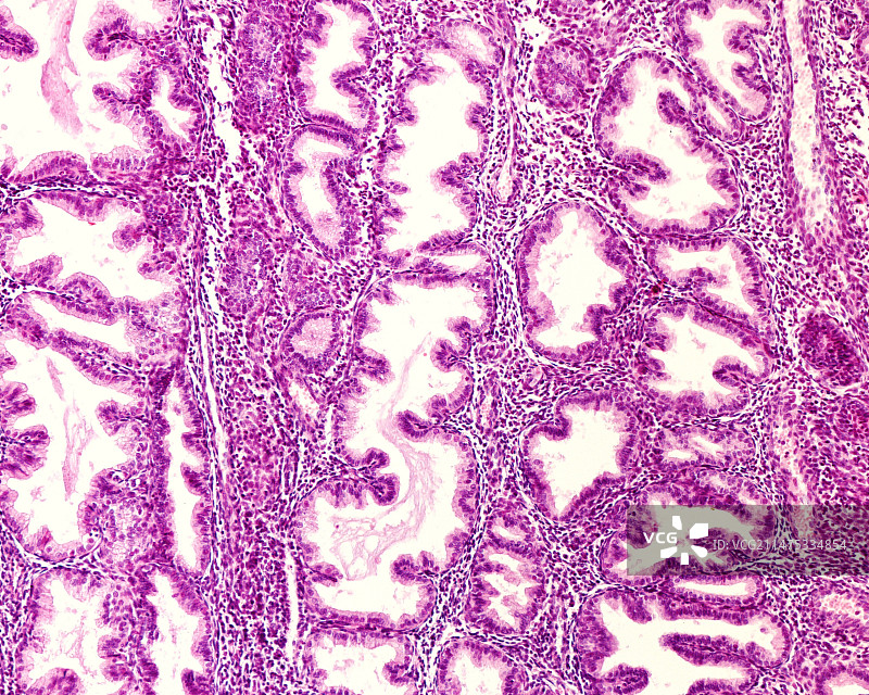 分泌期子宫内膜腺体光学显微照片图片素材