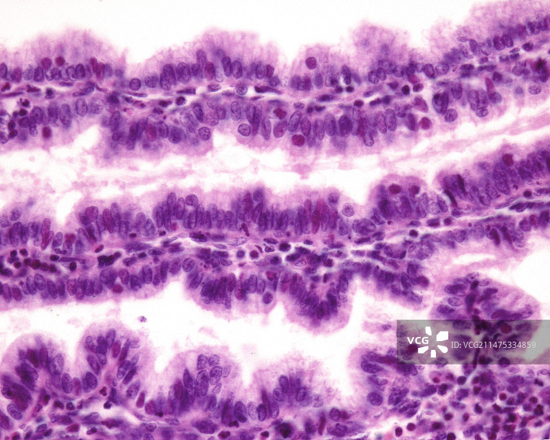 分泌期子宫内膜腺体光学显微照片图片素材