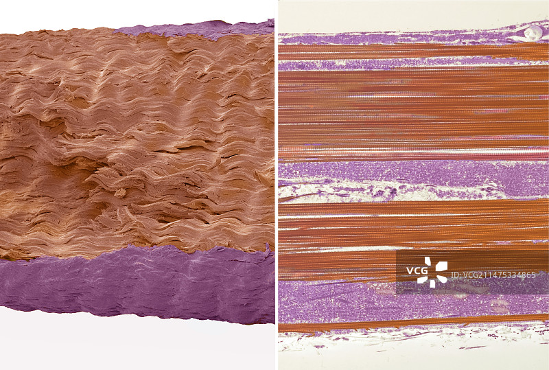 肌腱的扫描电镜-透射电镜对比图片素材