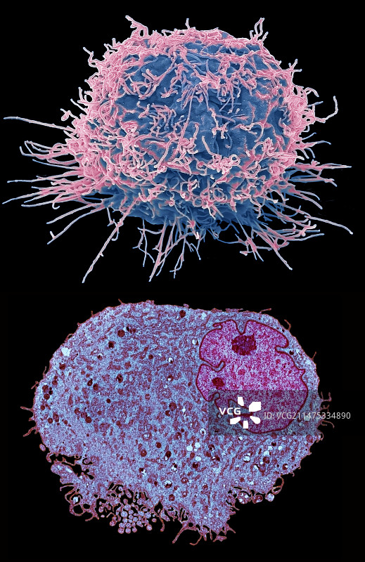 白血病细胞SEM-TEM对比图片素材