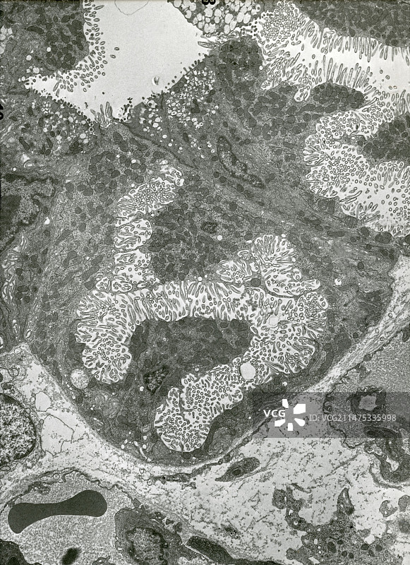 胃壁细胞，TEM图片素材