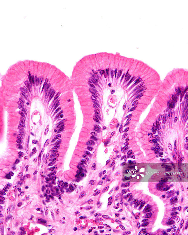 胃表面上皮细胞，光学显微照片图片素材