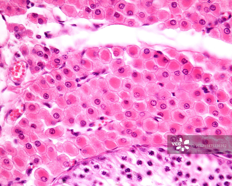 莱迪格细胞显微照片图片素材