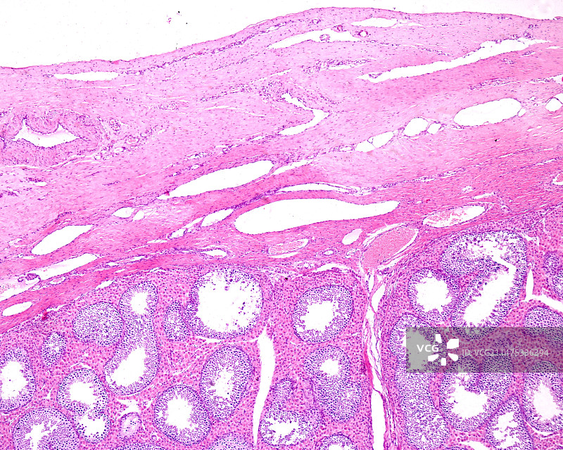 睾丸白膜浅显微照片图片素材