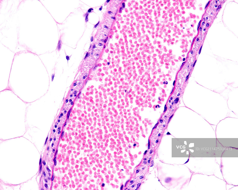 小动脉显微照片图片素材