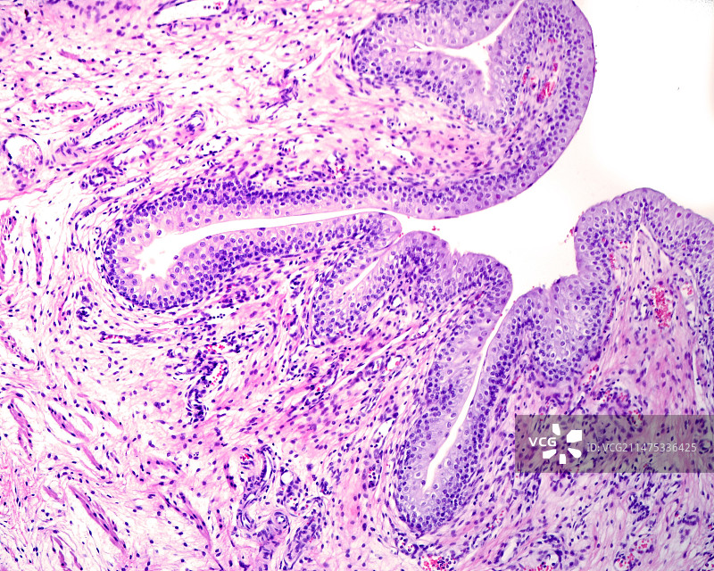膀胱黏膜显微照片图片素材