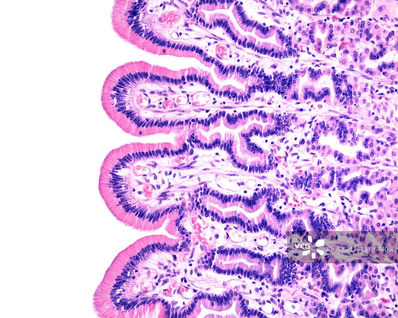胃表面上皮细胞，光学显微照片图片素材